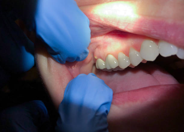 Best Cracked Tooth Emergency Dentist  in Nicholasville, KY